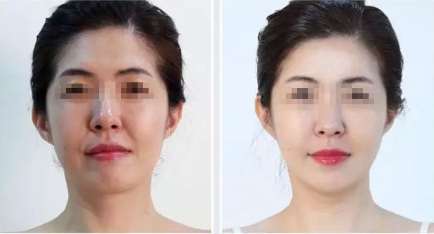 濟寧哪家整形醫(yī)院評價好，口碑排名靠前的有哪些？