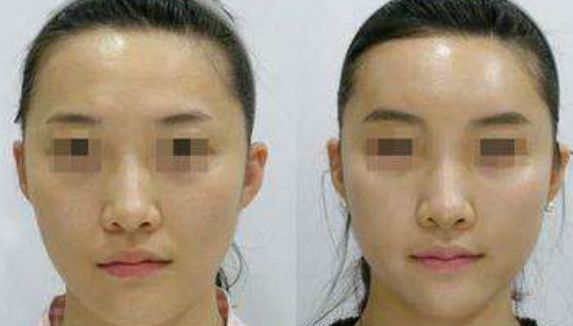 上海拉皮手術(shù)推薦排名揭曉！8位知名專家評選完整名單！