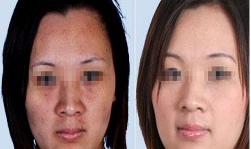 3家值得信賴的廣州整形醫(yī)院推薦