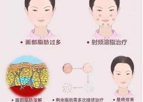 徐州二院整形美容科專家評價及服務(wù)項目介紹，陶常波醫(yī)生特長領(lǐng)域一覽