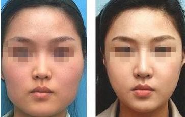 【2024】濱州去眼袋醫(yī)院排名前六強(qiáng)，最新醫(yī)院詳解！