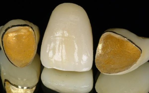 洛陽植發(fā)醫(yī)院哪家好？前十名名單公開，雍禾、華美參考價曝光