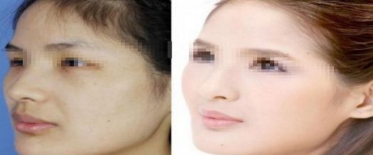 上海微整形醫(yī)院哪家好？