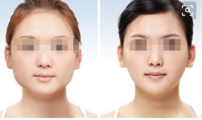 濟(jì)南減肥醫(yī)院有哪些？