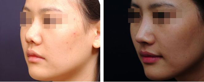 福建整形醫(yī)院TOP10評選結果即將揭曉