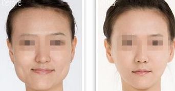 黑龍江三甲整形醫(yī)院熱門榜單，前三強(qiáng)大揭秘！