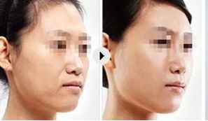 上海頂尖美容整形醫(yī)院精選，讓你真正了解排行榜