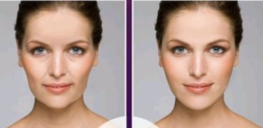 合肥市最好的祛痣整形醫(yī)院排行榜揭曉