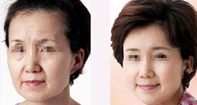 柳州市人民醫(yī)院整形科優(yōu)質(zhì)服務，專設專業(yè)咨詢及手術設施