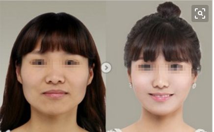 梅州皇佳貝麗整形醫(yī)院2023全新提升，醫(yī)療技術(shù)引領(lǐng)新潮流