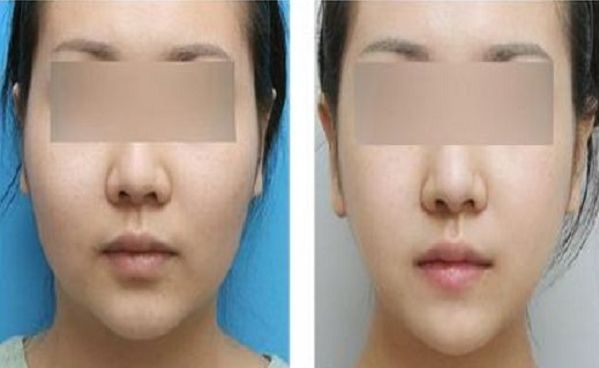 武漢亞韓整形外科醫(yī)院口碑如何？先進(jìn)醫(yī)療技術(shù)吸引普遍關(guān)注！