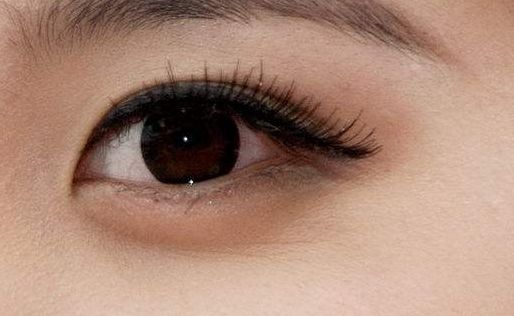 重慶軍美吸脂效果怎么樣？真實(shí)案例見證顯著術(shù)后效果