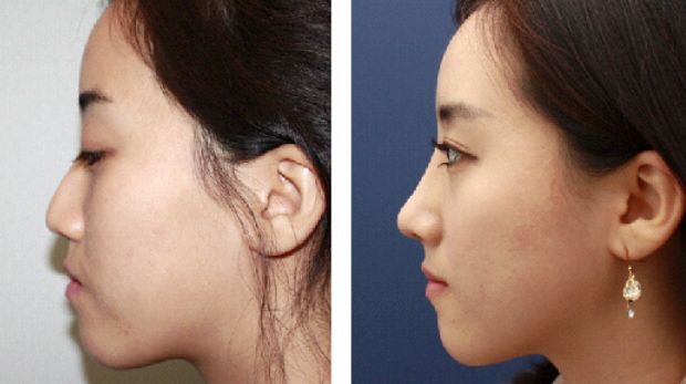 呼和浩特整形醫(yī)院排名大揭秘，了解哪家更靠譜！