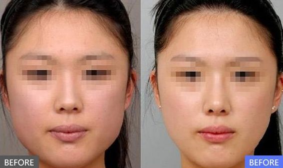 成都整形美容醫(yī)院綜合排行榜Top10出爐！這些醫(yī)院受歡迎程度堪比明星哦！