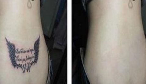 雙眼皮手術(shù)醫(yī)院推薦，一站式解決開眼角問題