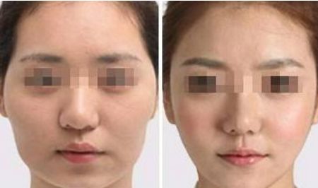 武漢熙蒙整形醫(yī)院信譽(yù)如何醫(yī)生介紹、費(fèi)用更新了！