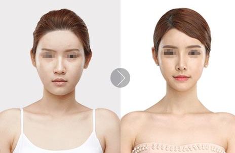 上海整形醫(yī)院排行榜：十家獨特選擇，追求美麗者歡聚一堂！