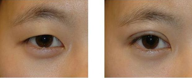 吉林市人民醫(yī)院的整形美容項目全面解析