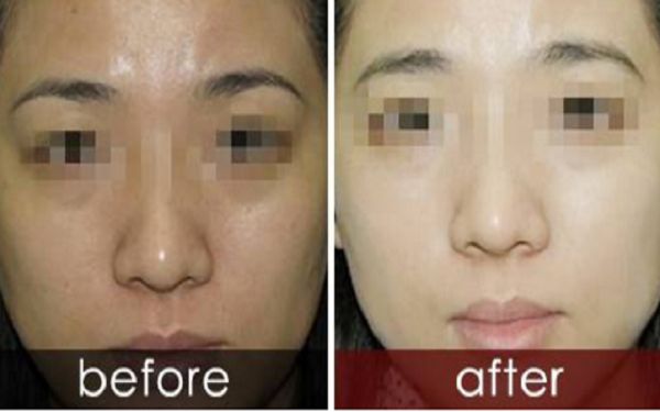 深圳優(yōu)質(zhì)的私立整形美容醫(yī)院推薦