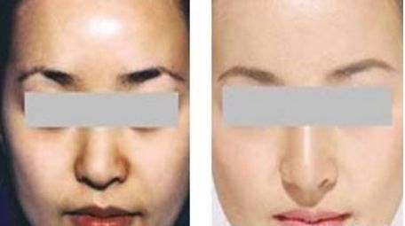 【2024全國頂級(jí)隆鼻醫(yī)院科普】大連top10醫(yī)院排行榜揭曉