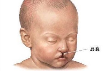 最新盤點(diǎn)：沈陽隆胸整形醫(yī)院大排行，人氣醫(yī)生與價(jià)格揭秘