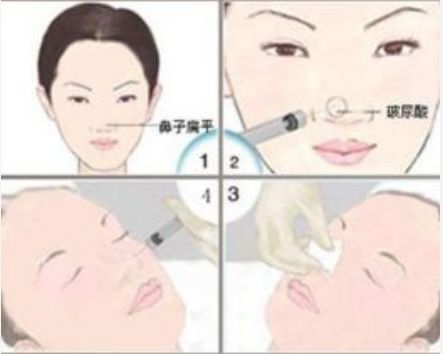 邯鄲維多利亞美容醫(yī)院體驗(yàn)全解析：門(mén)診介紹及價(jià)格指南