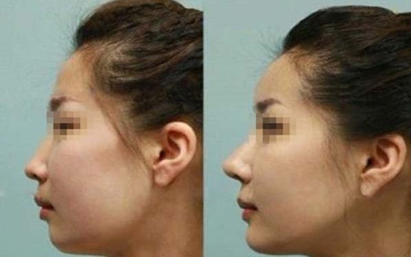 清明節(jié)鄭州中醫(yī)一附院趙絳波出診時間表