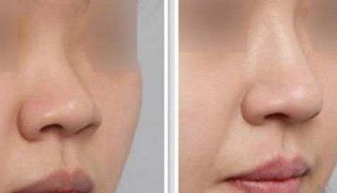 沈陽(yáng)杏林醫(yī)院官網(wǎng)詳解領(lǐng)先技術(shù)，臉部果展示讓你重獲自信