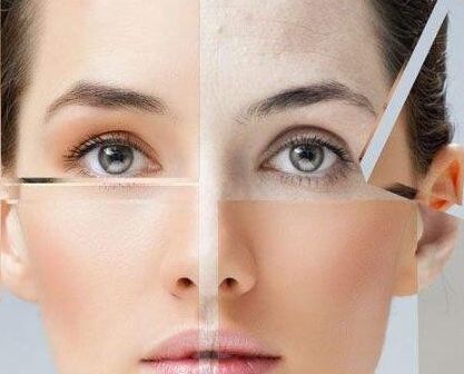 11月16日，喬雅登緹顏國內(nèi)首發(fā)發(fā)布會(huì)震撼北京，沈陽百嘉麗首發(fā)力挺