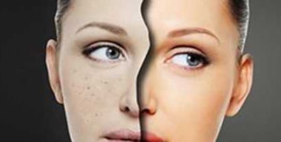 盤點2024年武漢哪家醫(yī)院能夠進(jìn)行自體脂肪填充術(shù)