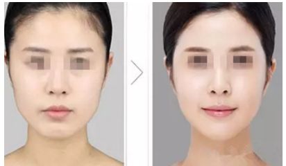 恩施地區(qū)優(yōu)秀整形醫(yī)院排行榜單出爐！