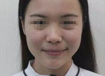 南充疤痕整形醫(yī)院排名精選，助你尋找完美去疤痕之旅