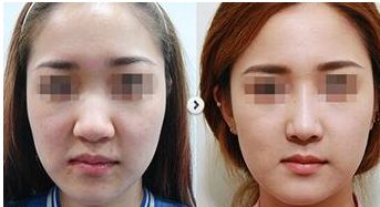 西安疤痕修復(fù)醫(yī)院口碑榜單，這4家實(shí)力出眾