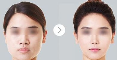 廣州耳再造醫(yī)院綜合評價曝光，醫(yī)療技術領跑全國