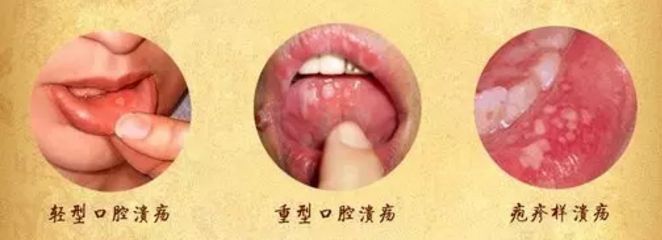 北京眼袋整形醫(yī)院排名大揭秘，最佳去眼袋選擇！