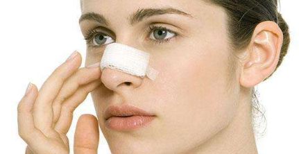 找醫(yī)生修復(fù)雙眼皮，怎樣找到醫(yī)生王莉莉的優(yōu)秀案例？