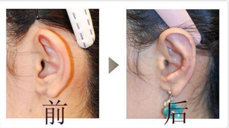 成都友誼醫(yī)院疤痕科：設(shè)備先進(jìn)、技術(shù)精湛，治療效果如何？