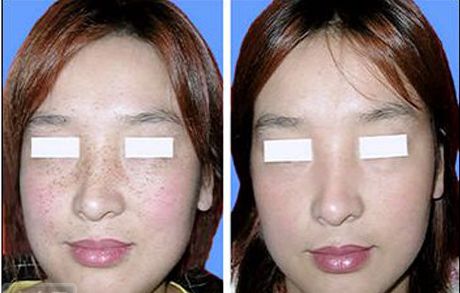 陜西推薦的優(yōu)質(zhì)疤痕修復(fù)醫(yī)院列表