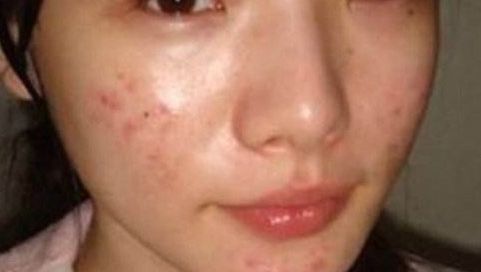 北京眼科醫(yī)院排名榜單揭曉，何氏、同仁入選！附近視眼手術費用一覽