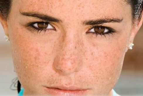 南通蜂巢皮秒哪個(gè)醫(yī)院靠譜？華顏、伊萊等嶄露頭角！