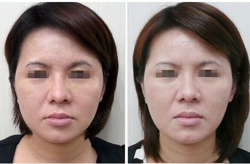 廣元整形美容醫(yī)院排行榜：口碑推薦+專業(yè)技術(shù)