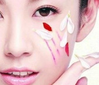 南通哪家醫(yī)院能夠有效改善嘴角開大問題？