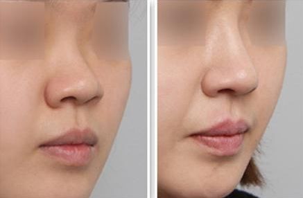 深圳整形醫(yī)院實力盤點！最受用戶歡迎的醫(yī)院排行榜揭曉