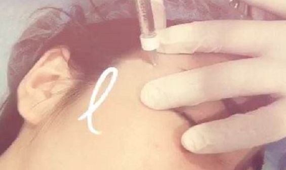 深圳前海地區(qū)哪家整形醫(yī)院比較靠譜？好的深圳整容醫(yī)院有哪些？