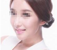 2024年太原頂級整形醫(yī)院排名曝光，專家評選出的前10強！