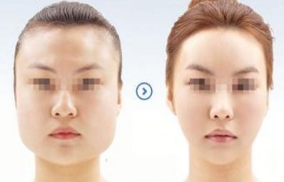 2024年溫州哪家醫(yī)院的整形美容效果最佳？