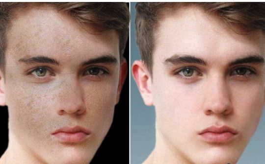 深圳哪里可以有效改善額頭問題，專業(yè)治療推薦