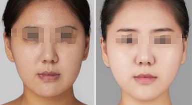 2024年惠州哪些整形醫(yī)院口碑好？