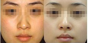 成都珀媛醫(yī)療美容服務(wù)水平如何？醫(yī)院介紹及費用大公開