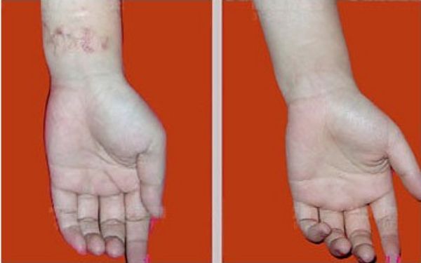 【雙眼皮專家駕到！武漢中翰整形醫(yī)院付毅院長親診雕刻美眼】